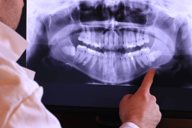 Best Broken or Cracked Tooth Emergency Dentist in Bally, PA