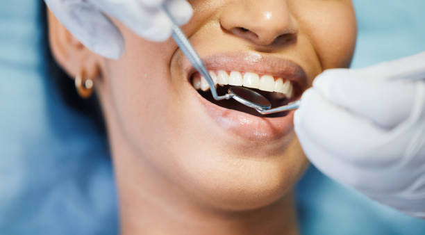Best Emergency Dental Care for Abscessed Tooth in Bally, PA